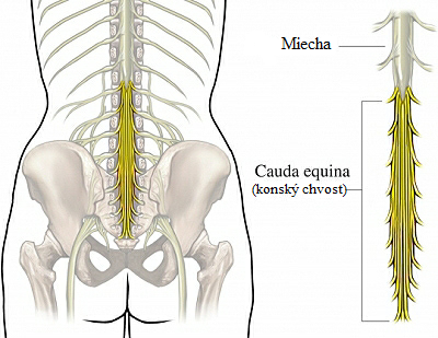 cauda equina